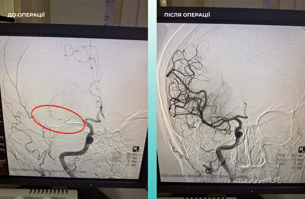 8903 image for slide